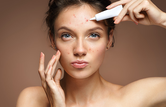 Redness And Acne Redness And Acne