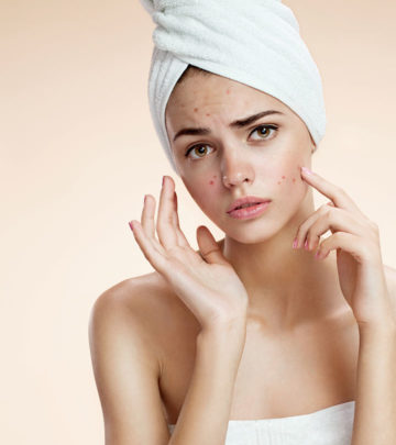 Vitamin A For Acne: Is it An Effective Treatment?_image