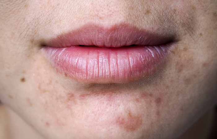 What Happens When You Don't Take Care Of Your Skin What Happens When You Don't Take Care Of Your Skin