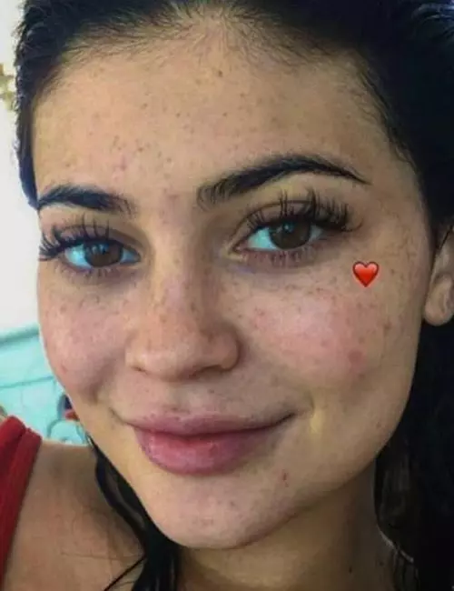 Freckle Love