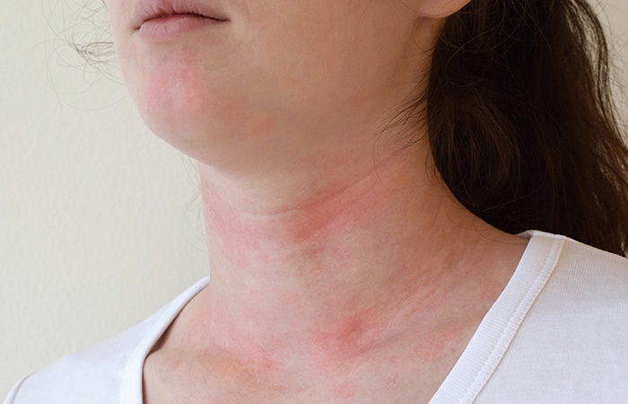 Side Effects Of Light Therapy Side Effects Of Light Therapy