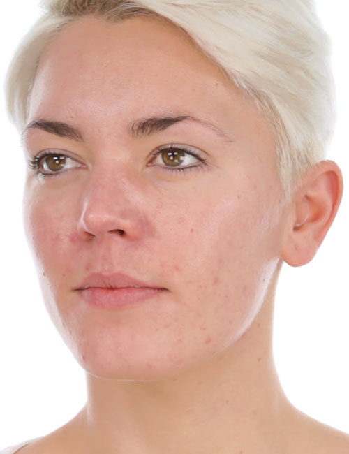 Step 1 Prep Your Skin