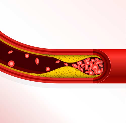 What Is Cholesterol And Why Is It Important