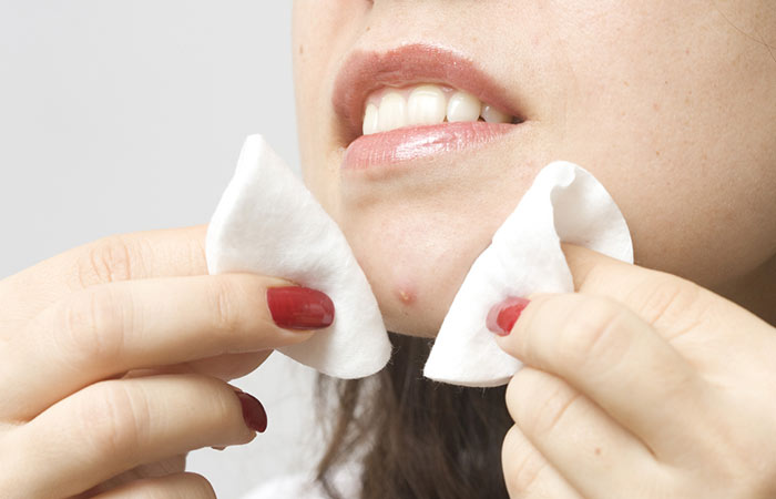 How-To-Pop-A-Pimple-the-Right-Way