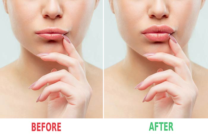 Plump Your Lips