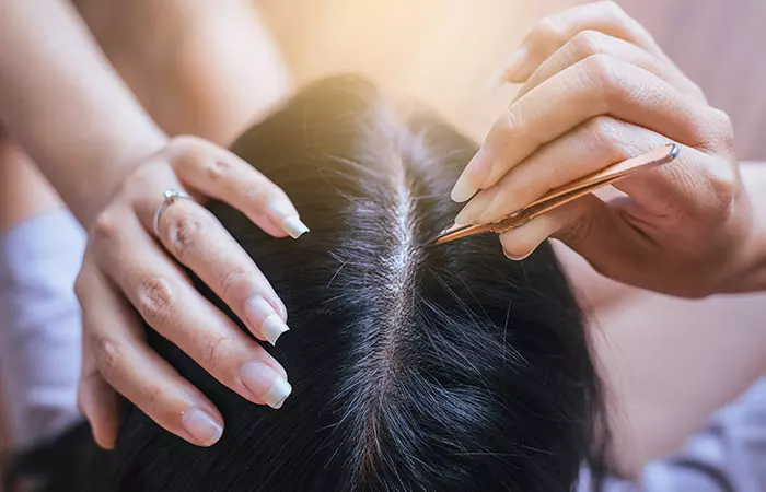 Chances Are That Multiple Grey Hairs Sprout From The Exact Same Place