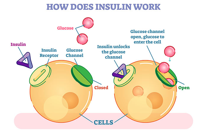 What-Causes-Hypoglycemia