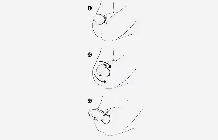 Safe birthing technique, nuchal cord in pregnancy Safe birthing technique, nuchal cord in pregnancy