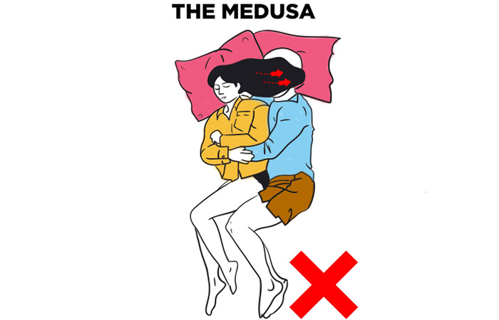 The Medusa