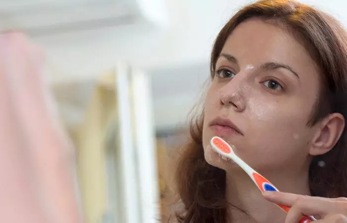 Toothpaste Is A Great Quick-Fix For A Pimple