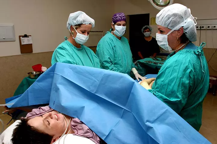 Caesarean Delivery