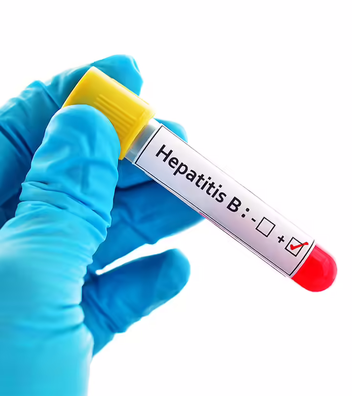 What Is Hepatitis B Symptom Cause Diagnosis And Treatment