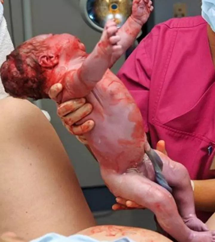 This Is What It looks like To watch Your Baby Being Born_image