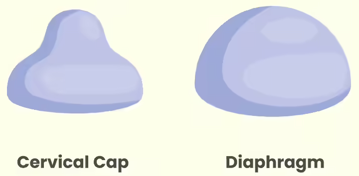 Cervical cap as non-hormonal birth control method Cervical cap as non-hormonal birth control method