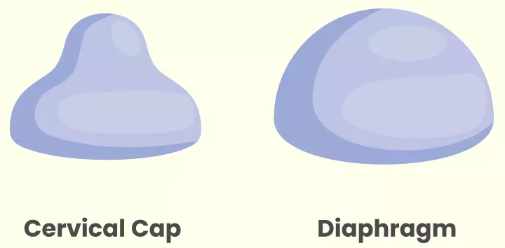 Cervical cap as non-hormonal birth control method