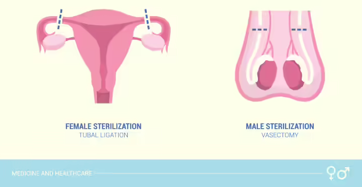 Surgical sterilization as non-hormonal birth control method Surgical sterilization as non-hormonal birth control method