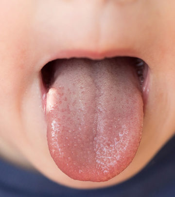 If You Have Bumps On Your Tongue, Here’s What They Could Mean_image