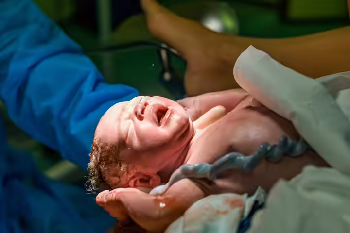 Umbilical Cord Accidents