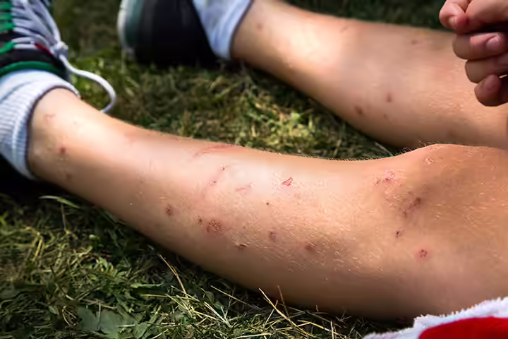 What To Do When I Find A Tick On My Child
