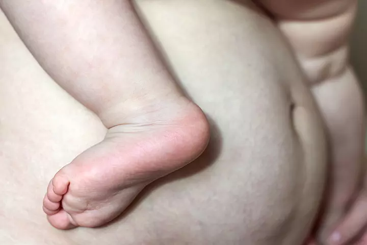 You Might Still Have A Bump After Birth