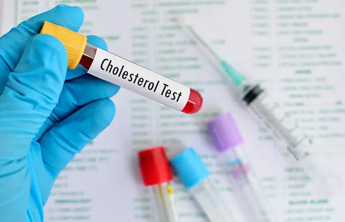 Cholesterol