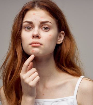 Antibiotics For Acne – Everything You Need To Know About Them