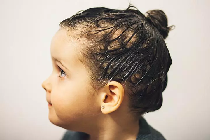 How To Get Rid Of Head Lice