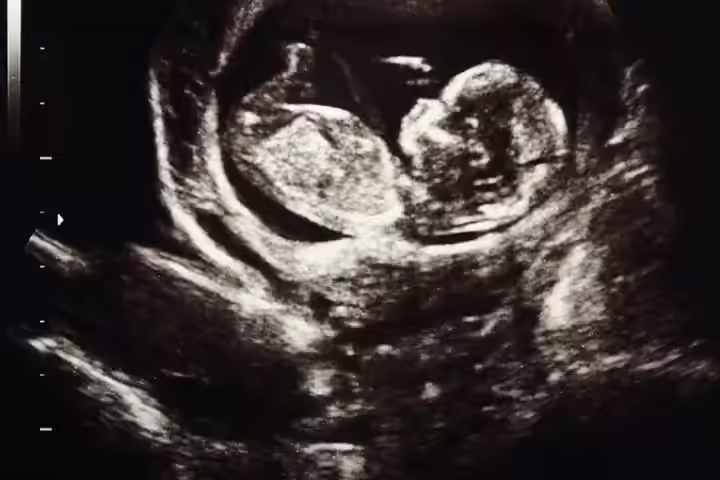 Week 13