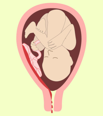 implantation-bleeding