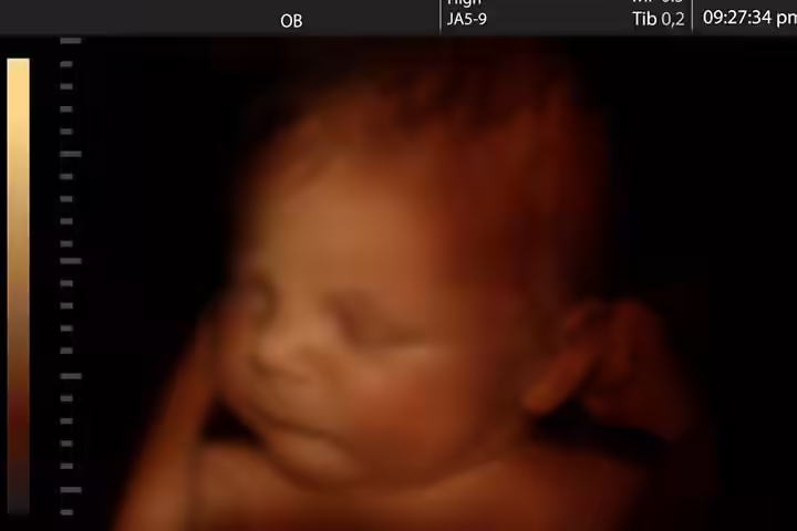 Can My Baby Taste Before She's Born