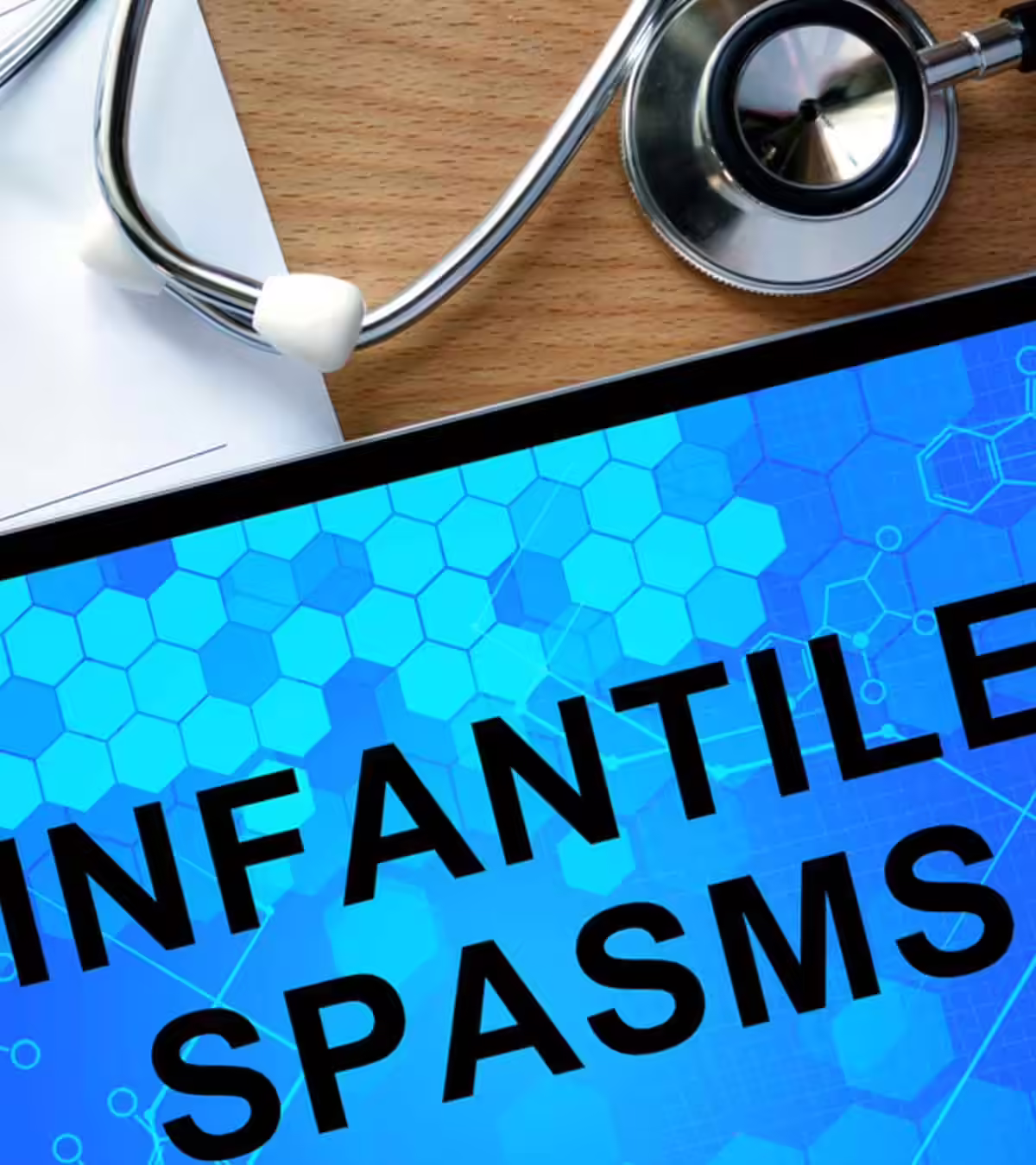 Infantile Spasms Symptoms, Causes, Diagnosis And Treatment