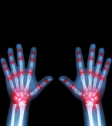 9 Symptoms Of Arthritis In Children, Causes And Treatment