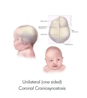 An irregularly shaped skull requires immediate medical attention for your baby.