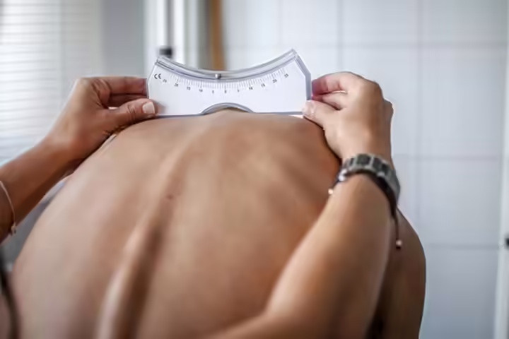 The forward-bending test for determining scoliosis in children The forward-bending test for determining scoliosis in children