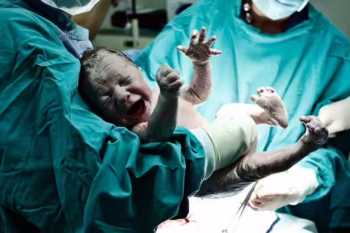c-section-babies-develop-slower