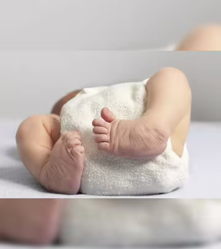 Clubfoot In Babies In Hindi