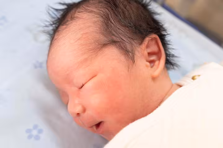 What Causes Caput Succedaneum Swelling On The Head In Newborns