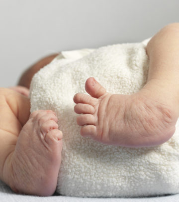 What Is Clubfoot In Babies? Causes, Symptoms And Treatment