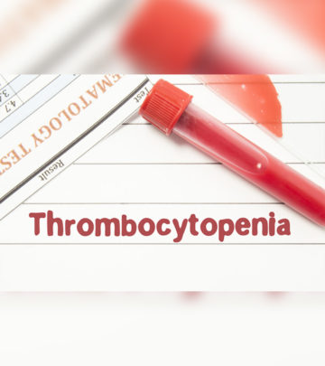 Platelet dysfunction causes thrombocytopenia, which is treatable by platelet transfusions.