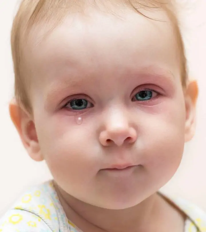 Pink eye in toddlers