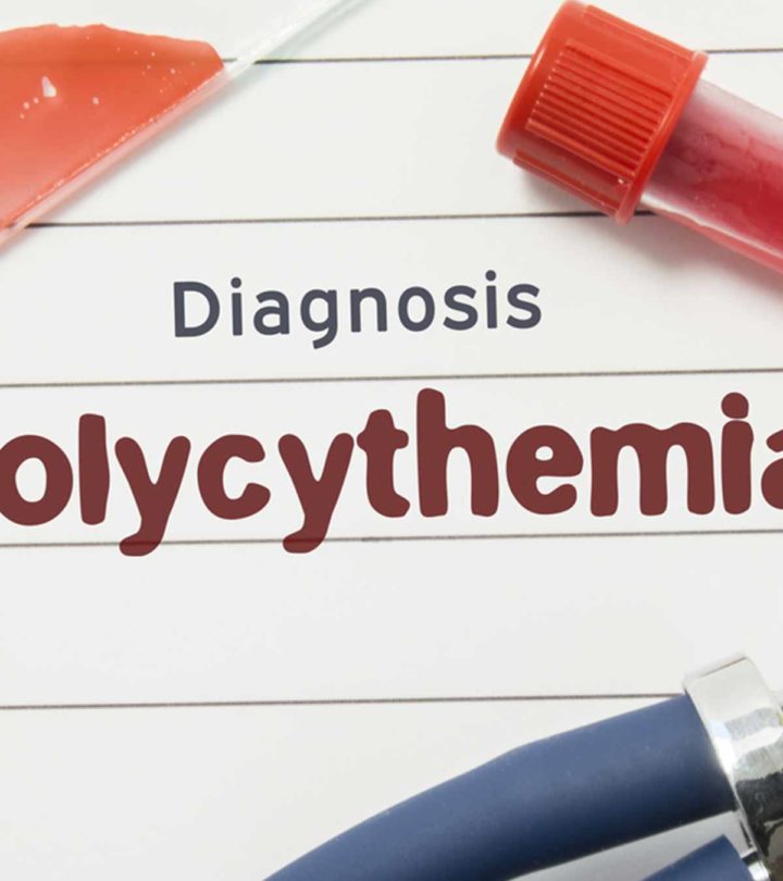 Polycythemia In Newborn Causes, Symptoms And Treatment