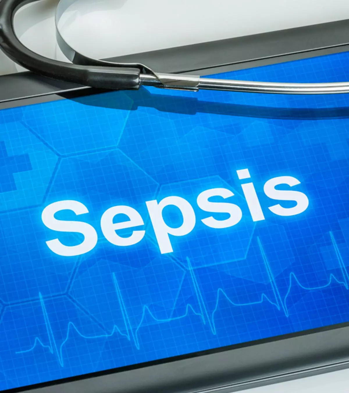 Abnormal breathing, heart rate, fever, and other symptoms may indicate neonatal sepsis.