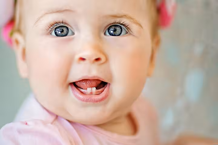 Crooked Teeth In Babies Is This Normal, Cause And Prevention-1
