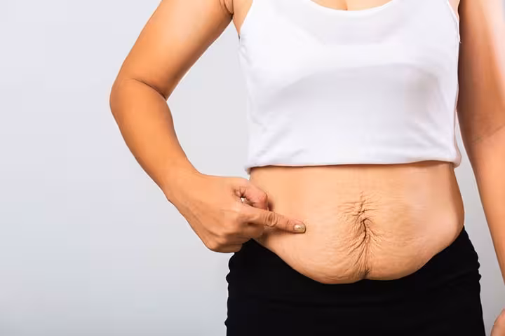 Diastasis Recti After Pregnancy In Hindi-1