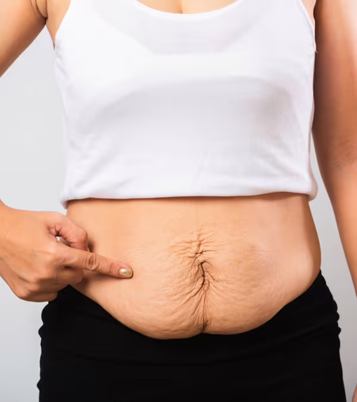 Diastasis Recti After Pregnancy In Hindi