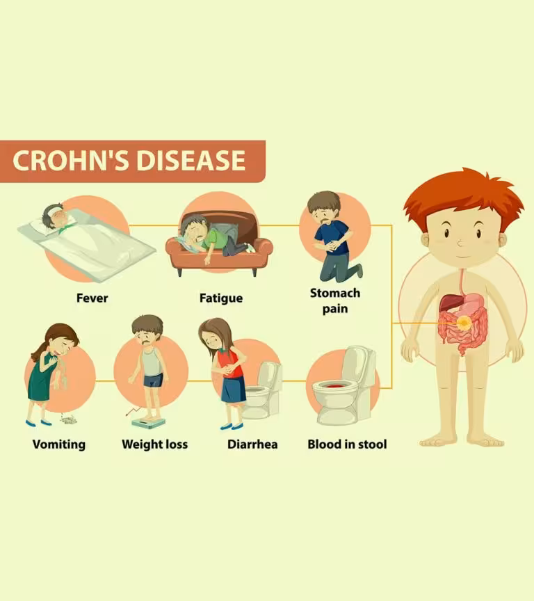 Crohn's Disease In Children Causes, Diagnosis, And Treatment