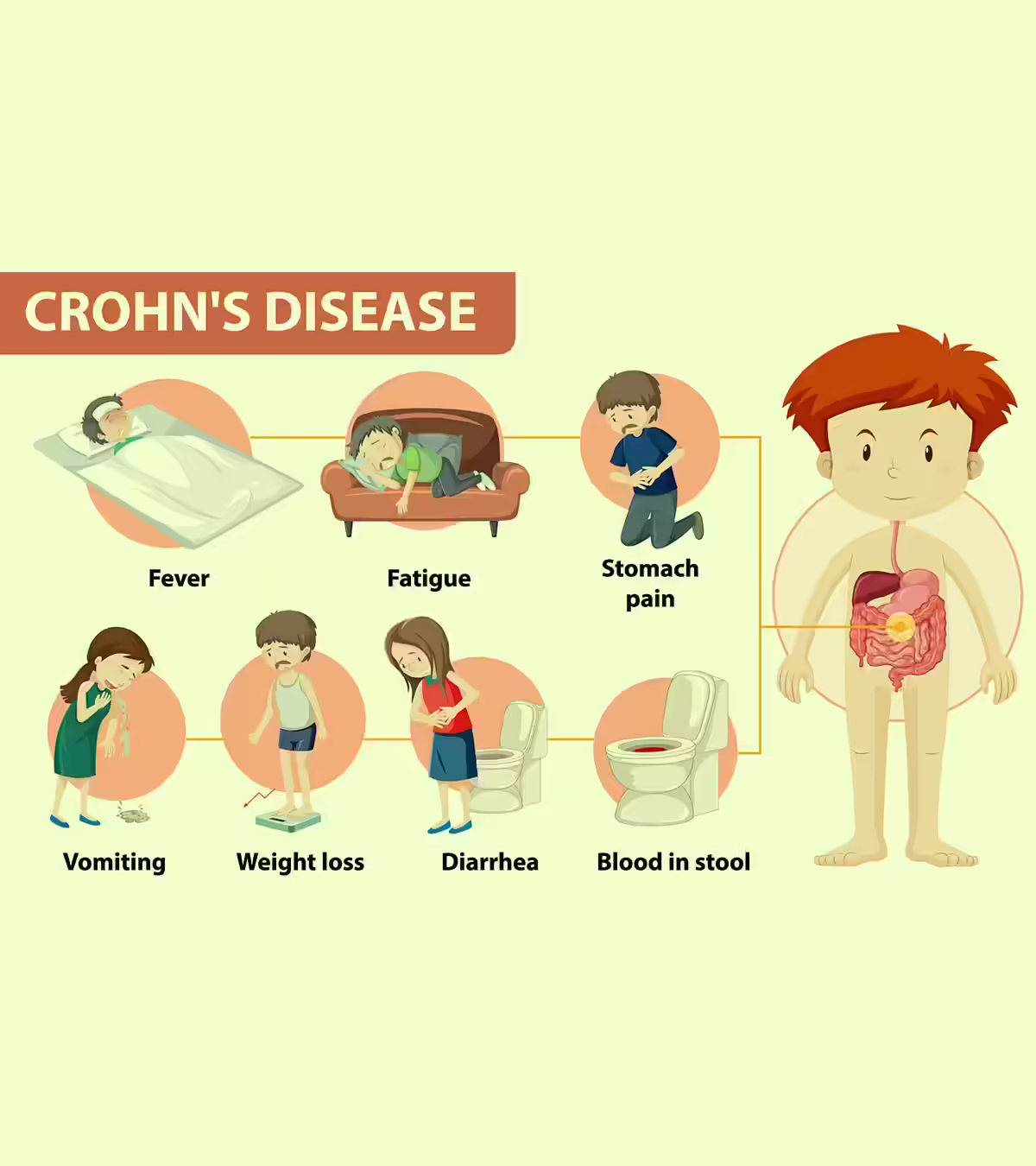 Crohn's Disease In Children Causes, Diagnosis, And Treatment