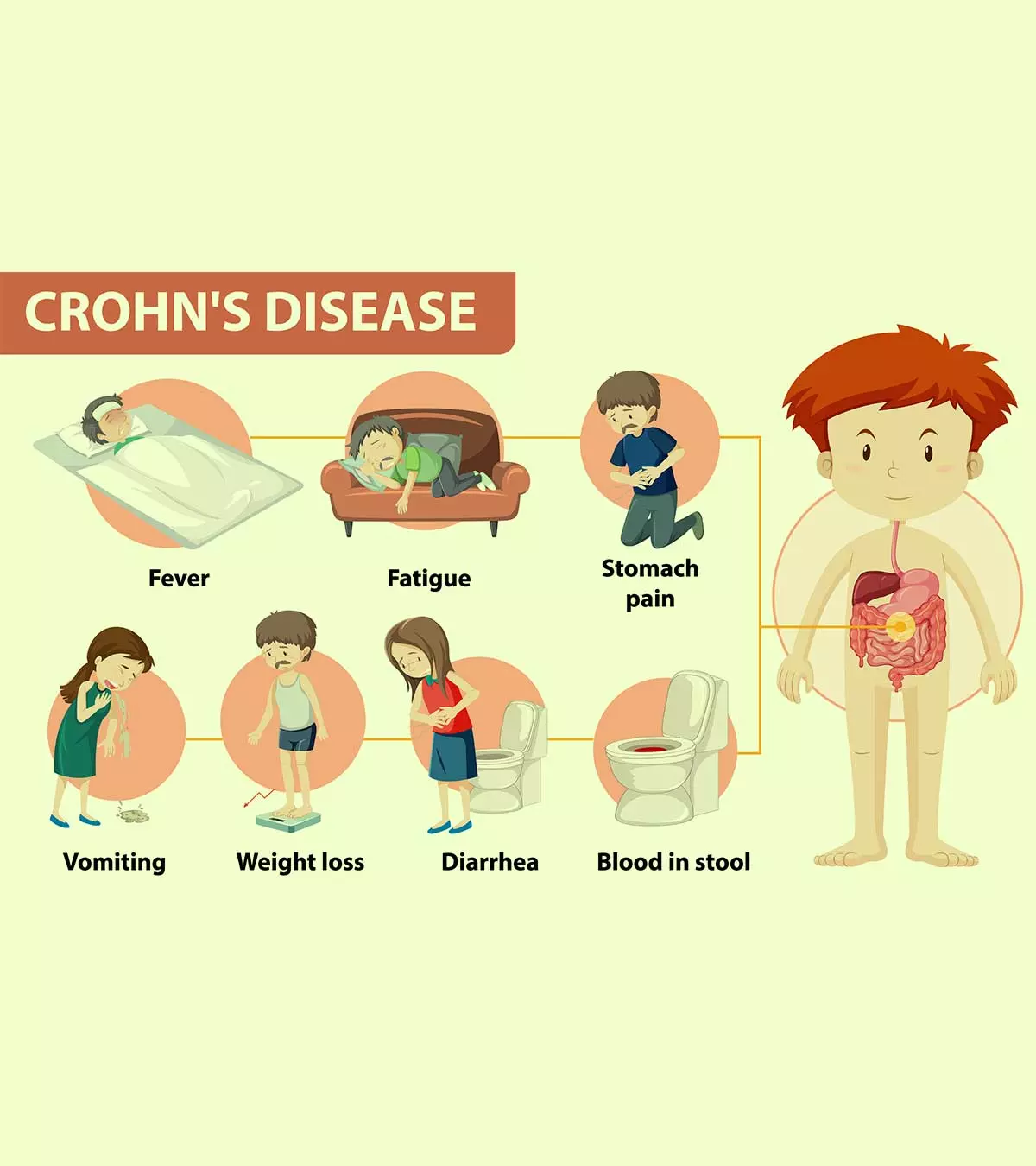 Gastrointestinal symptoms, malnutrition, and growth failures are common in the pediatric population with Crohn's disease.