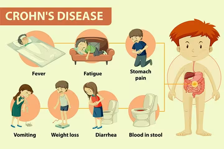 Crohn\'s Disease In Children