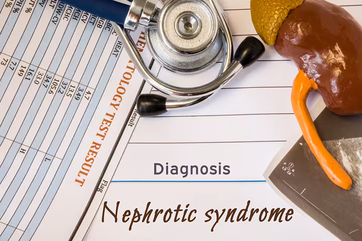 Nephrotic Syndrome In Children Nephrotic Syndrome In Children